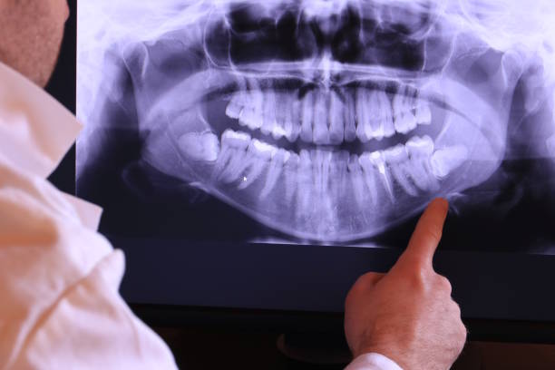 Best Mobile Emergency Dentist in Westmont, IL